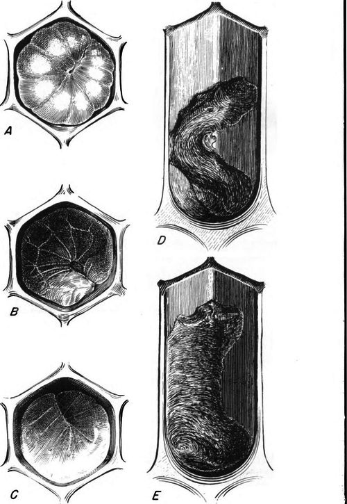 Honey bee larvae killed by European foulbrood, as seen in the cells.