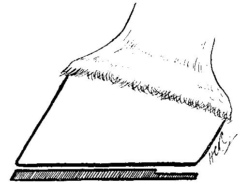 Fig. 104.   Shoe With A 'Dropped' Heel