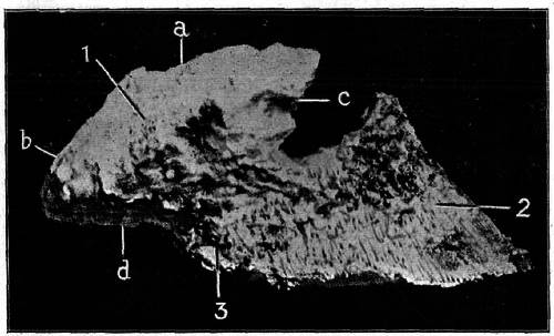 Fig. 16.   External Face Of The Outer Lateral Cartilage