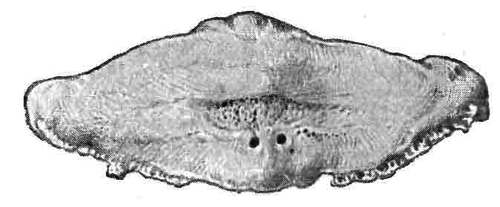 Fig. 161. Navicular Bone (Postero Inferior Surface) Showing The 'Worm Eaten' Appearance Caused By Erosion Of The Hyaline Cartilage, And Commencing Rarefactive Arthritis