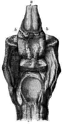 Fig. 162. A Foot With The Seat Of Navicular Disease Exposed