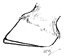 Fig. 65. The Thinned Tip