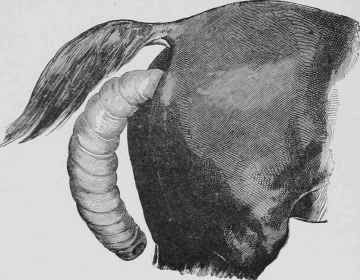 Inversion of the Rectum.