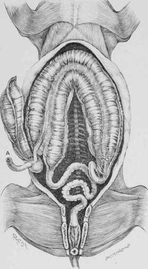 Large Intestine, showing its Position in the Abdomen.