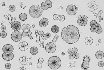 Urine Salts.