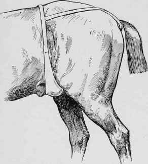 Orchitis Testicle Suspended.