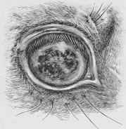 Cloudy Cataract.