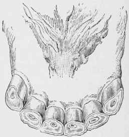 Incisors of Mare at ten years.