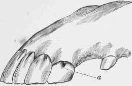(a) Groove at the side of Upper Corner Incisor at ten years.