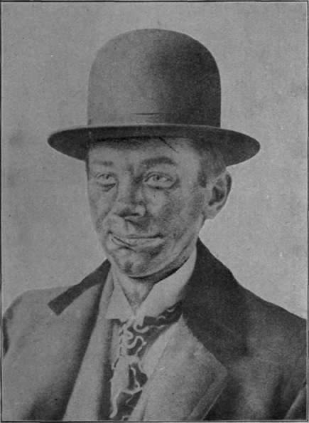 Fig. 32.
