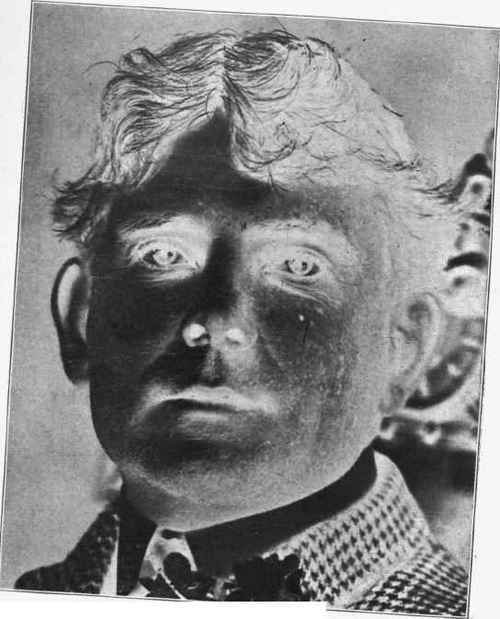 Illustration No. 3. Reproduction of Negative before Retouching