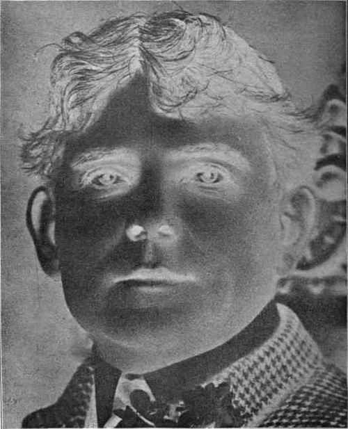 Illustration No. 4. Reproduction of Negative Retouched