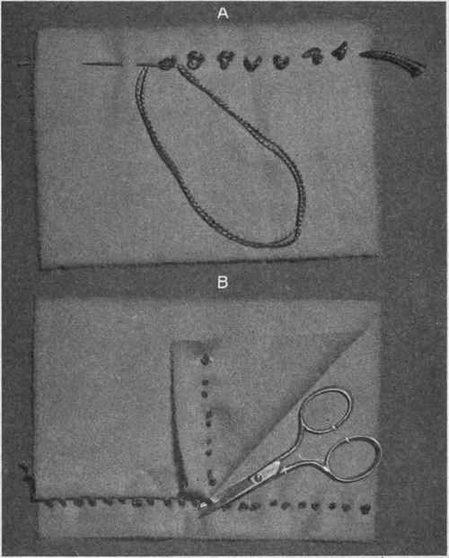 Fig. 183.   Tailor tacking or basting; A, making the stitches; B, cutting through the stitches to separate the two pieces of cloth.