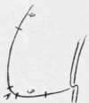 Fig. 35.   Gouges marked on design.