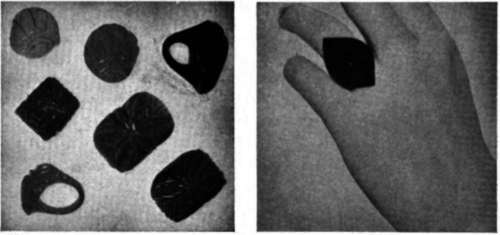 Various Designs Of Arvcd Rings, Made From Ring Tabes