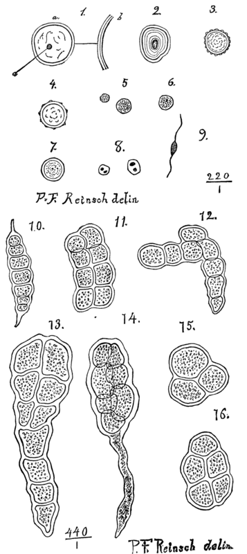 Ague Plants In The Urine 385 12a