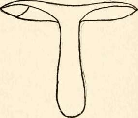 Section of R. emetica