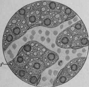 Fatty degeneration.