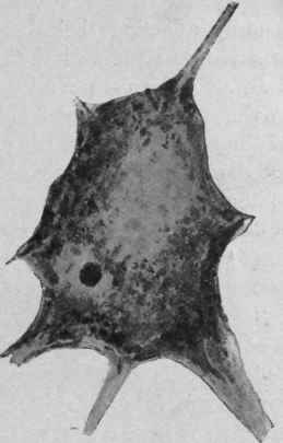 Morbid Changes In Nervous System 93