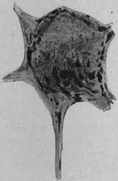 Morbid Changes In Nervous System 94