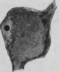 Morbid Changes In Nervous System 95