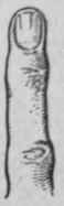 Developed joints