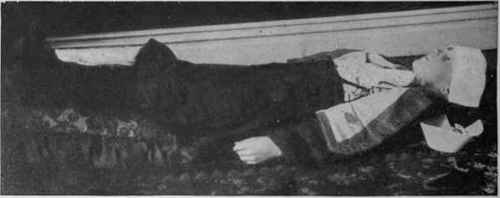 Fig. 1. In cases of fainting lay the patient flat upon the floor, with head on or below the level of the body