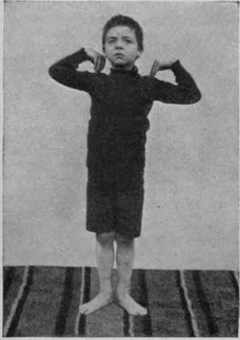 Fig. 1. Standing erect with finger tips on shoulders