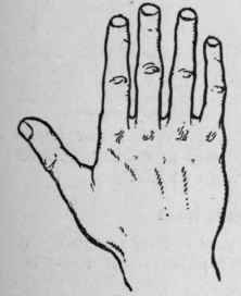 Fig. 1. The Elementary Hand. This is the most primitive type and is found only in extremely cold countries, such as Siberia.
