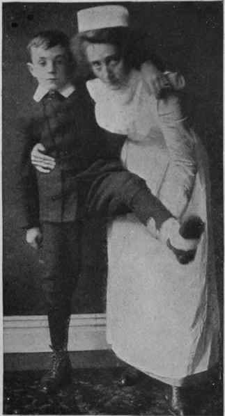 Fig. 2. Assisting a patient with an injured leg when only one helper is available