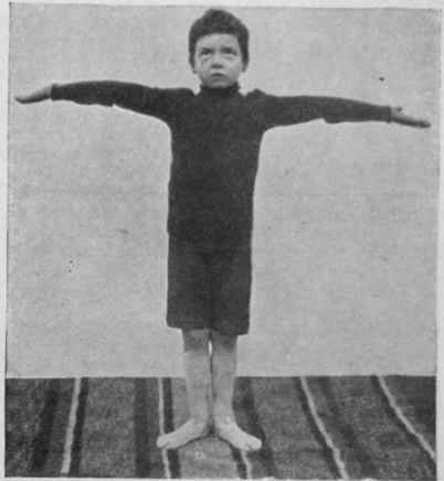 Fig. 2. The arms held out level with the shoulders