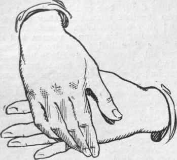 Fig. 2. The back of the hand should be rubbed towards the wrist with the palm of the other hand