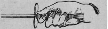 Fig. 4. Hand in supination   that is, with the palm uppermost