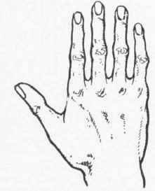 Fig. 4 'he Philosophic Hand. This is the hand common among Orientals, among people ever seeking wisdom, and who delight in the mysterious and in studying mankind.