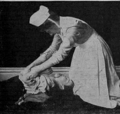 Fig. 5. Restoring respiration: second position