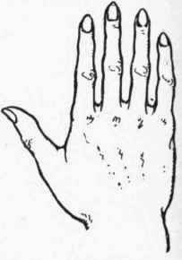 Fig. 6. The Psychic Hand. This type of hand is rarely found pure. It is possessed by people who are essentially unpractical and unbusinesslike.