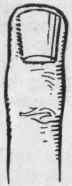 Long nails, bluish in tint, are the sign that the owner's circulation is poor