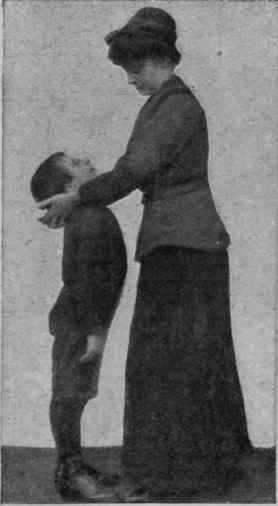 Fig. I. An exercise to remedy a poking chin