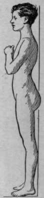 Hollow back, a condition which can also be remedied by suitable exercises the ribs, others do the reverse