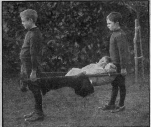 Carrying the wounded to the dressing station. The stretcher consists of two brooms, passed through the sleeves of a coat. The sleeves are turned inside out and the coat is then buttoned down the front