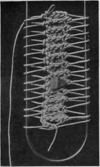 Fig. 5. Bar stitch. A simple variation of the ordinary hairpin