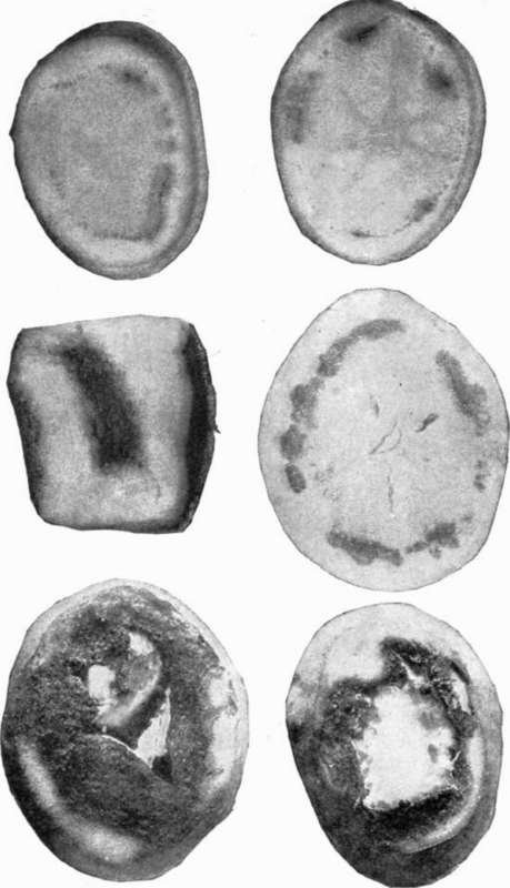 Various stages in destruction of potato tubers by Fusarium.