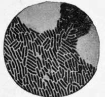 Fig. 16. Bacteria causing typhoid fever, as seen under the microscope.