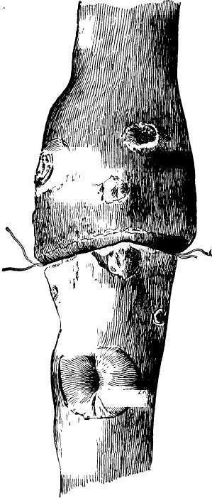 Stem of young tree girdled by wire