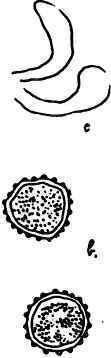 Spores of Rose Rust.