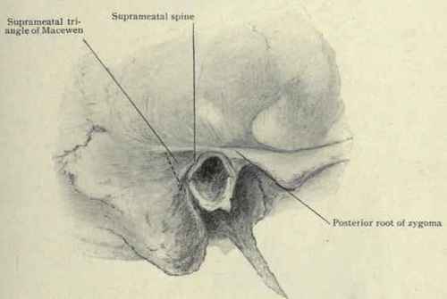 Fig. 107.   Landmarks for operating to enter the mastoid antrum.