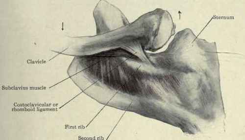 Fig. 243.   Dislocation of the sternal end of the clavicle upward and forward, showing how the first rib acts as a fulcrum and the clavicle as a lever.