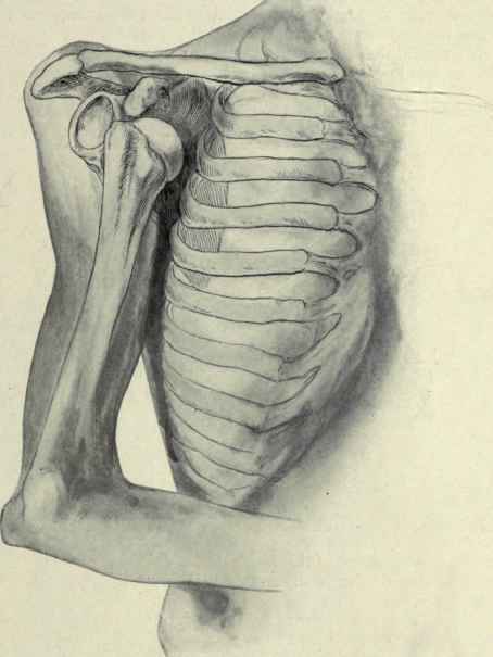 Fig. 247.   Subcoracoid dislocation of the humerus, showing the position of the bones in relation to each other and to the soft parts.