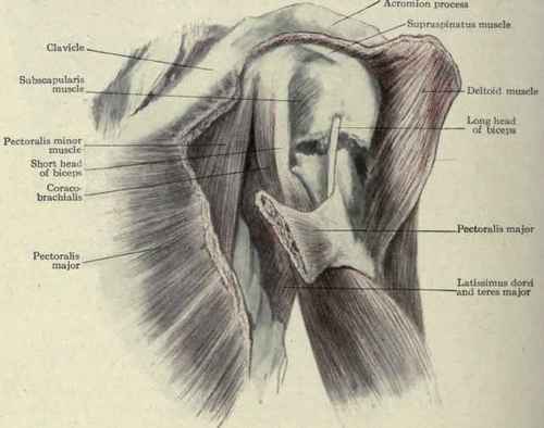 Fig. 261. Fracture of the surgical neck of the humerus.