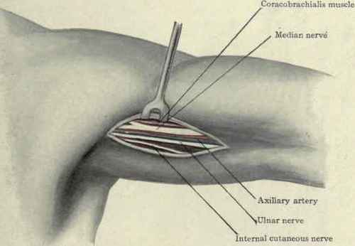 Fig. 273.   Ligation of the third portion of the axillary artery.